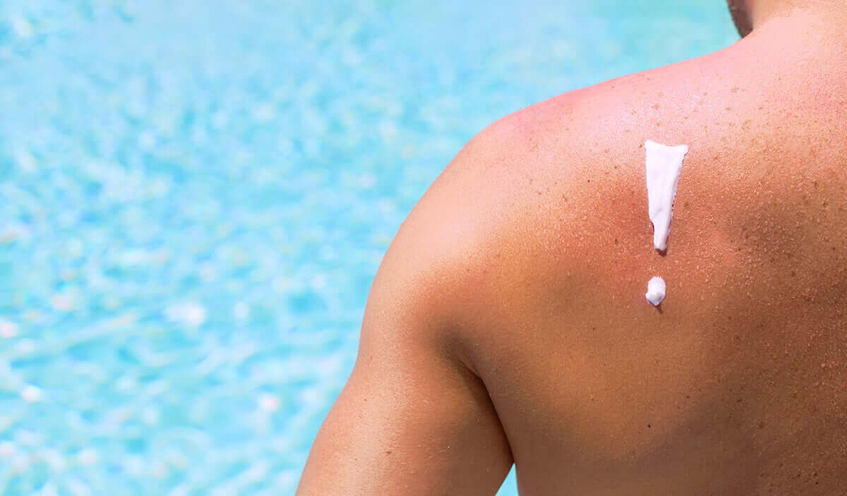 Cuidados com a pele no verão